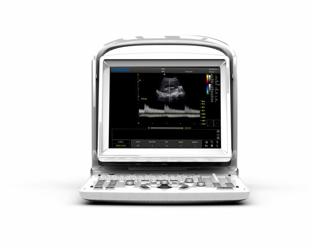 
                  
                    Chison ECO3Vet Veterinary Ultrasound Scanner And Micro-Convex Probe 5-8MHz
                  
                