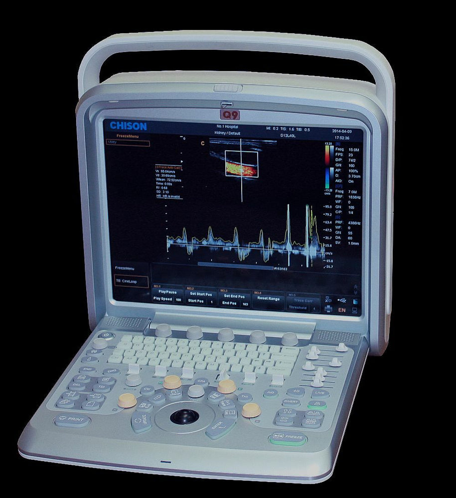 
                  
                    Chison Q9 Color Doppler Ultrasound Scanner With Two Probes Cardiac and Vascular
                  
                