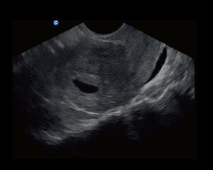 
                  
                    Chison ECO2 Powerful Affordable Lightweight 15" LED Ultrasound w/ Battery & Case
                  
                
