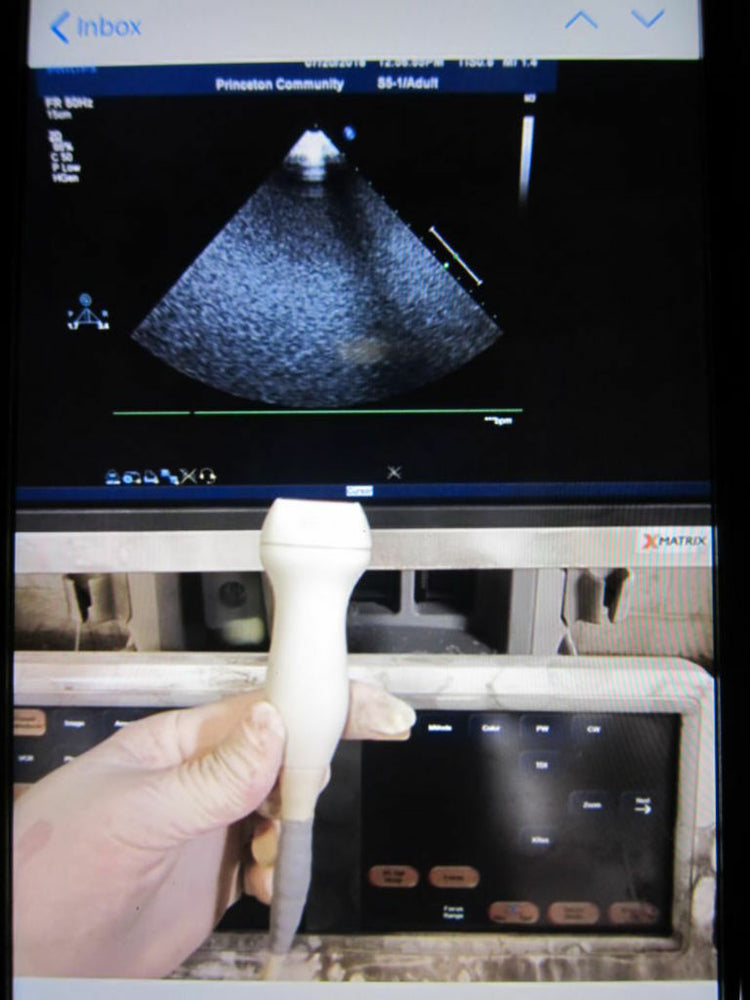 
                  
                    PHILIPS S5-1 Ultrasound Transducer, Probe (52DM)
                  
                