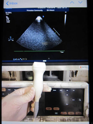 
                  
                    PHILIPS S5-1 Ultrasound Transducer, Probe (52DM)
                  
                