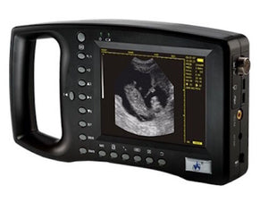 
                  
                    Small Palm Veterinary Ultrasound Scanner For Cows, Horses, Mares-Affordable
                  
                