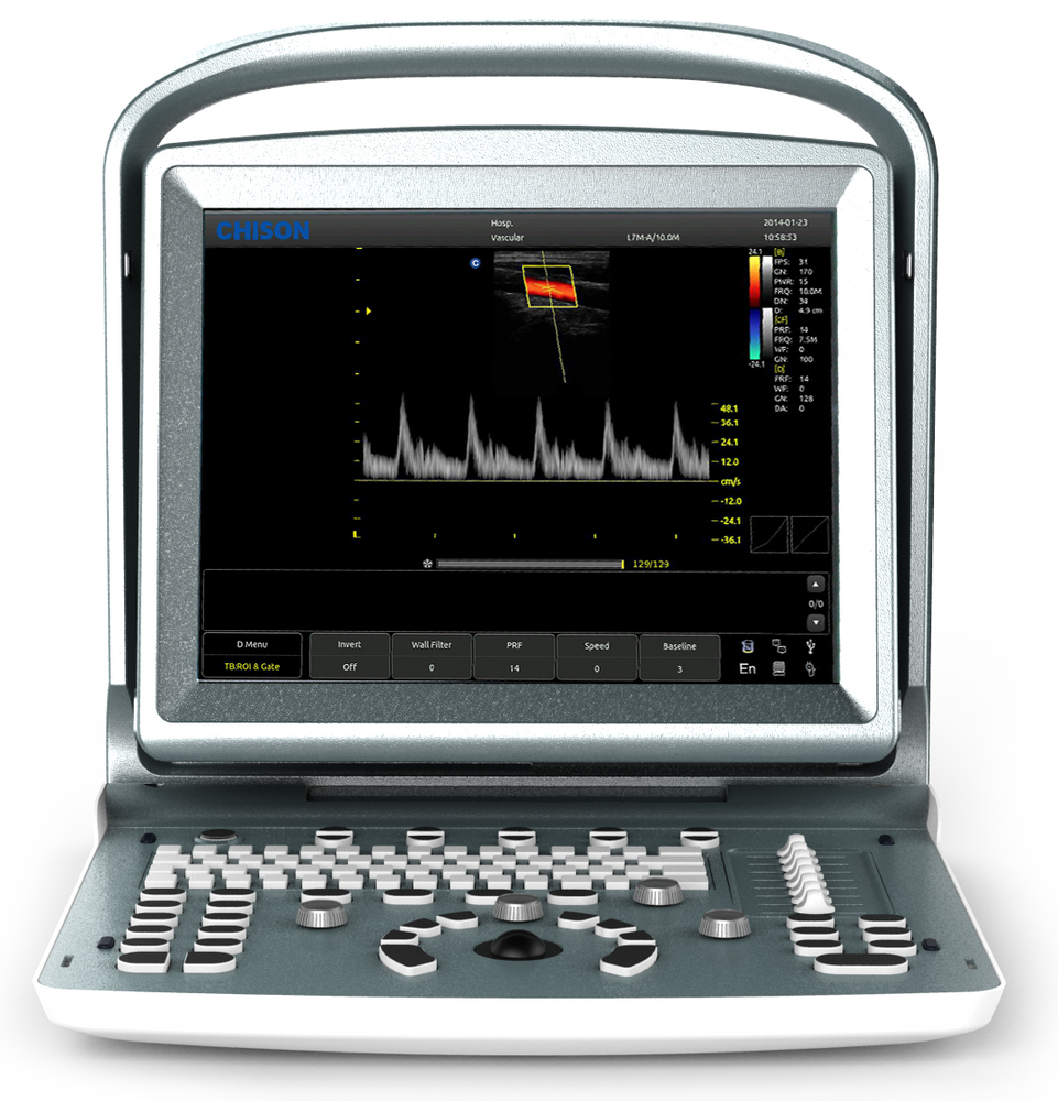 
                  
                    Chison ECO5 Color Doppler Ultrasound with One Probe
                  
                