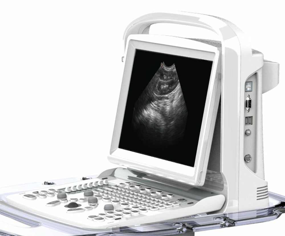 
                  
                    Chison ECO3, MSK, Tendon, Vascular Black/White Ultrasound Machine & Linear Probe
                  
                
