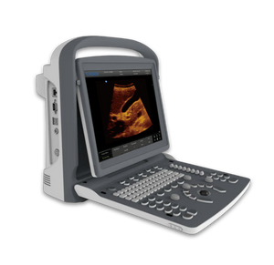 
                  
                    Chison ECO2 Powerful Affordable Lightweight 15" LED Ultrasound w/ Battery & Case
                  
                