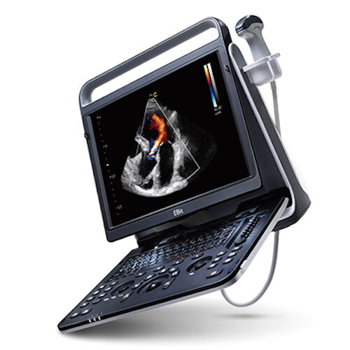 
                  
                    Chison eBit 60 Color Doppler Ultrasound Scanner CW w/ Cardiac and Linear Probes
                  
                