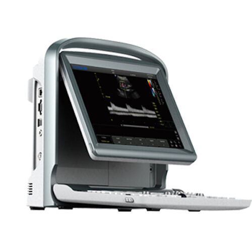 
                  
                    Affordable Color Doppler Ultrasound Machine Chison ECO5 With One Probe
                  
                