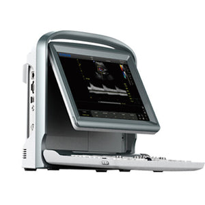 
                  
                    Affordable Color Doppler Ultrasound Machine Chison ECO5 With One Probe
                  
                