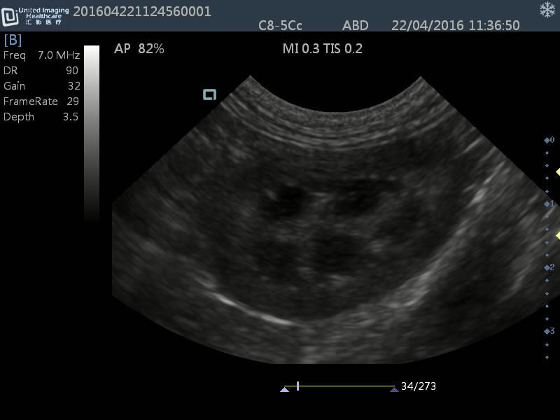 
                  
                    New Generation Laptop Veterinary Ultrasound 15" Screen & Rectal Probe, Keebomed
                  
                