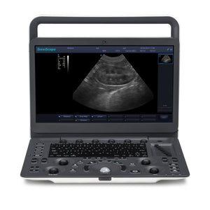 
                  
                    SonoScape A6V Expert (E1V) Veterinary Ultrasound - Micro Convex, Trolley, Bag
                  
                