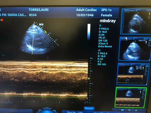 
                  
                    Mindray M9 Portable Ultrasound with 2 probes Phased array and linear array
                  
                