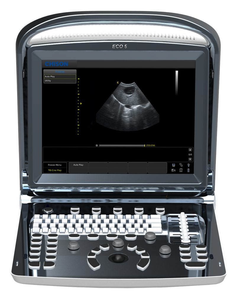 
                  
                    Affordable Color Doppler Ultrasound Machine Chison ECO5 With One Probe
                  
                