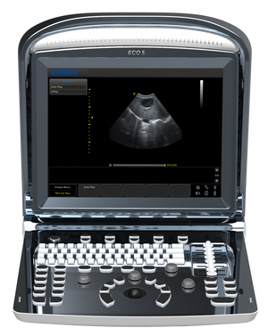 
                  
                    Affordable Color Doppler Ultrasound Machine Chison ECO5 With One Probe
                  
                