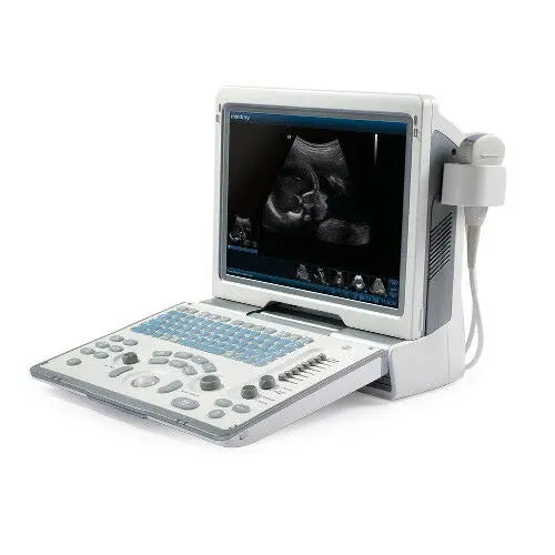 Best Quality Portable Ultrasound Machine With one Probe