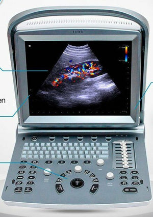 
                  
                    Deal on Demo Model Chison ECO5 Ultrasound with One Probe of Choice
                  
                
