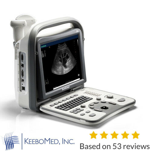 Ultrasound Machine Sonoscape A6 | Includes One Probe, Trolley, Bag, DICOM