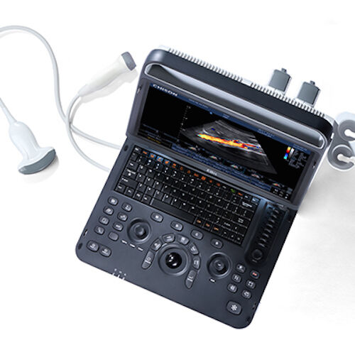 
                  
                    Chison eBit 60 Color Doppler Ultrasound Scanner CW w/ Cardiac and Linear Probes
                  
                