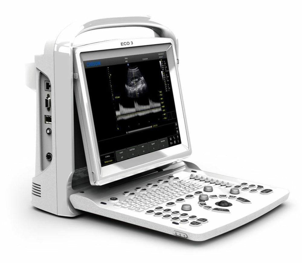 
                  
                    Chison ECO3, MSK, Tendon, Vascular Black/White Ultrasound Machine & Linear Probe
                  
                