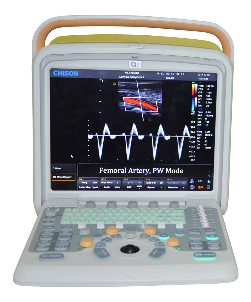 
                  
                    Color Doppler Ultrasound Scanner & Two probes Convex&Linear Probe - Chison Q5
                  
                