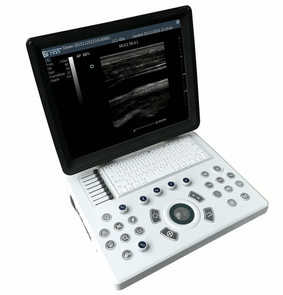 New Generation Laptop Veterinary Ultrasound 15