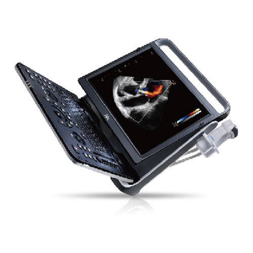 
                  
                    Chison eBit 60 Color Doppler Ultrasound Scanner CW w/ Cardiac and Linear Probes
                  
                