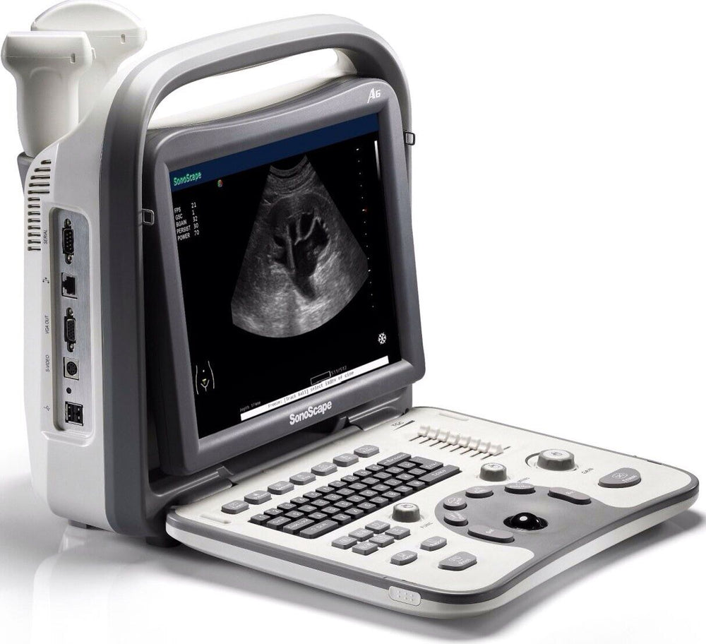 
                  
                    Ultrasound Machine Sonoscape A6 | Includes One Probe, Trolley, Bag, DICOM
                  
                