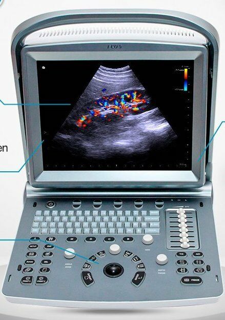 
                  
                    Chison ECO5 Color Doppler Ultrasound with One Probe
                  
                