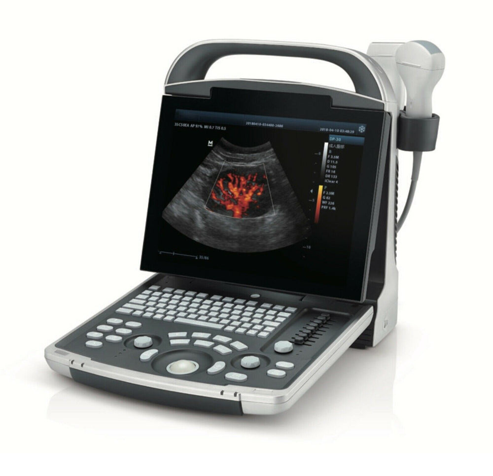 
                  
                    Color Doppler Ultrasound & One linear Array Probe
                  
                