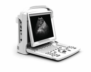 
                  
                    Chison ECO3 Vet Veterinary Ultrasound with one probe
                  
                