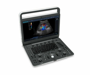 
                  
                    SonoScape E2 Color Doppler Vascular Ultrasound with Linear Array Probe L741
                  
                