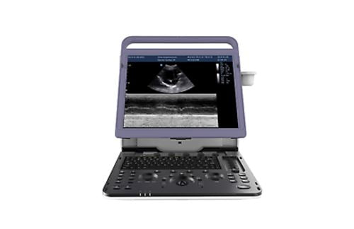 
                  
                    Chison eBit10Vet Veterinary High Frequency Portable Ultrasound with Two Probes
                  
                