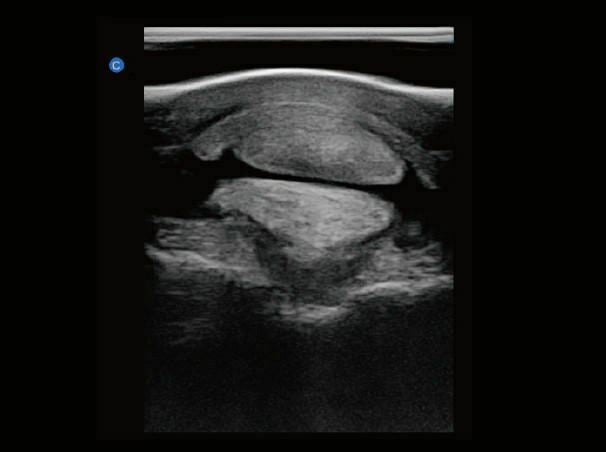 
                  
                    Chison eBit10 Amazing Quality Ultrasound with Linear Array Probe 5.0-15.0Mhz
                  
                