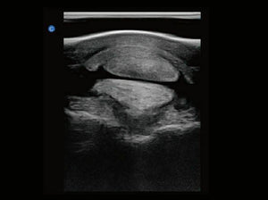 
                  
                    Chison eBit10 Amazing Quality Ultrasound with Linear Array Probe 5.0-15.0Mhz
                  
                