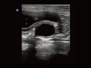 
                  
                    Chison eBit10 Amazing Quality Ultrasound with Linear Array Probe 5.0-15.0Mhz
                  
                