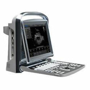 
                  
                    Color Doppler Portable Ultrasound Chison ECO5 Human Vascular/MSK/Abdominal
                  
                