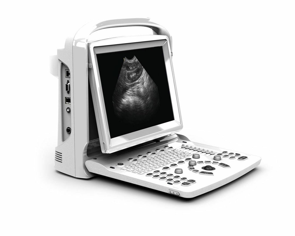 
                  
                    Ultrasound Chison ECO3, Amazing Quality wit Linear Array Probe, Includes Trolley
                  
                