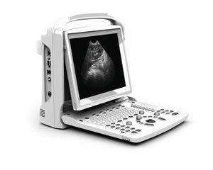 
                  
                    Ultrasound Chison ECO3, Amazing Quality wit Linear Array Probe, Includes Trolley
                  
                