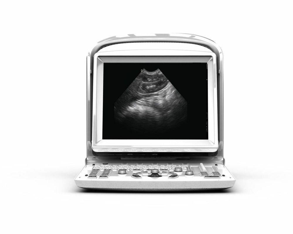 
                  
                    Ultrasound Chison ECO3, Amazing Quality wit Linear Array Probe, Includes Trolley
                  
                