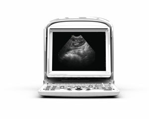 
                  
                    Ultrasound Chison ECO3, Amazing Quality wit Linear Array Probe, Includes Trolley
                  
                