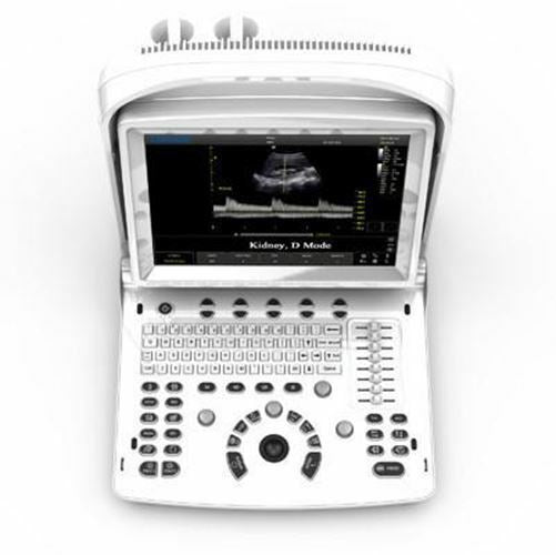 
                  
                    Ultrasound Chison ECO3, Amazing Quality wit Linear Array Probe, Includes Trolley
                  
                