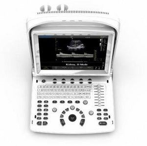 
                  
                    Ultrasound Chison ECO3, Amazing Quality wit Linear Array Probe, Includes Trolley
                  
                