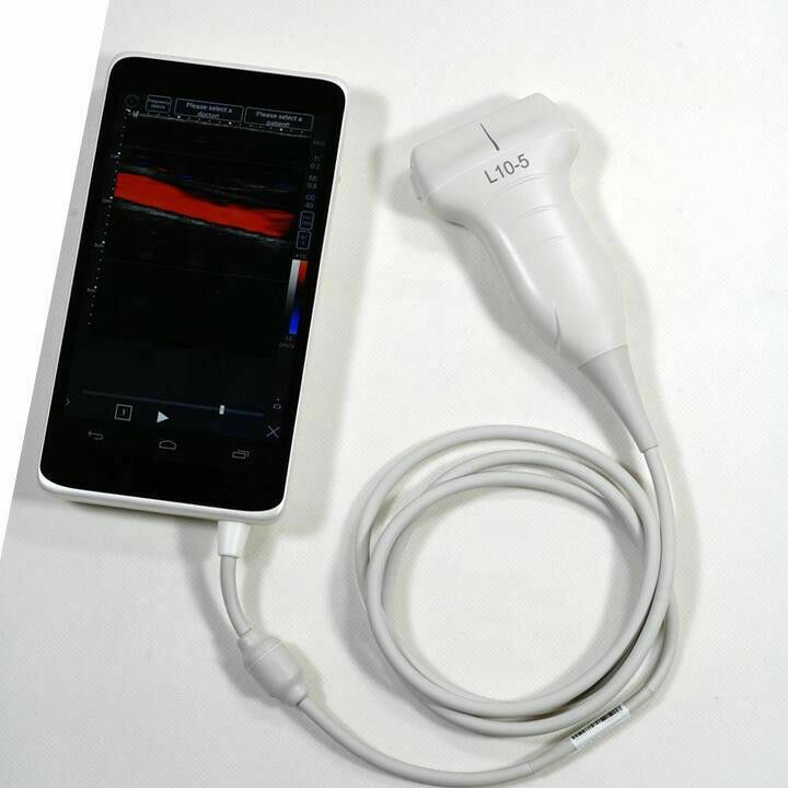 
                  
                    Pocket Size Color Doppler Smart Phone 6" Screen, and Linear Array Probe 5-10MHz
                  
                