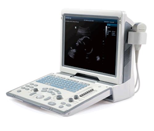 Mindray DP50 Ultrasound with one Linear Array probe 75L53EA