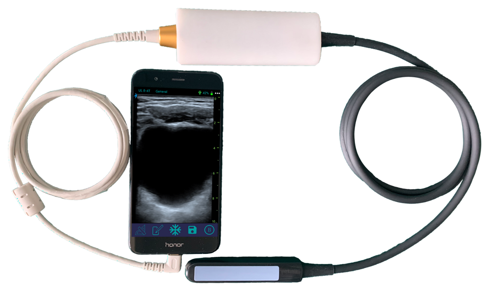 
                  
                    Veterinary Smart Phones Rectal Linear Probe for Large Animals for Android
                  
                