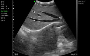 
                  
                    Wireless Fetal Doppler Convex Probe Veterinary Ultrasound for iPad, iPhone App
                  
                