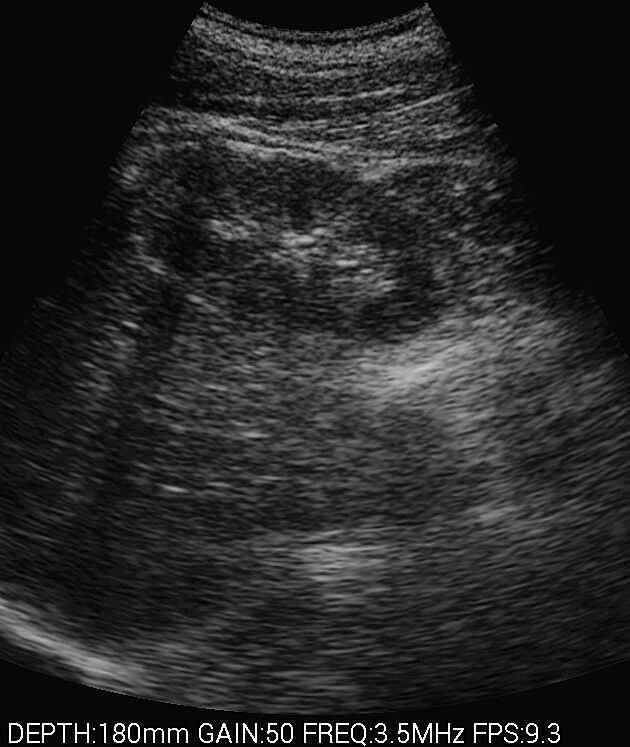 
                  
                    Veterinary Smart phones Ultrasound with  Convex probe 2.5-5MHz for Animals
                  
                