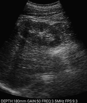 
                  
                    Veterinary Smart phones Ultrasound with  Convex probe 2.5-5MHz for Animals
                  
                