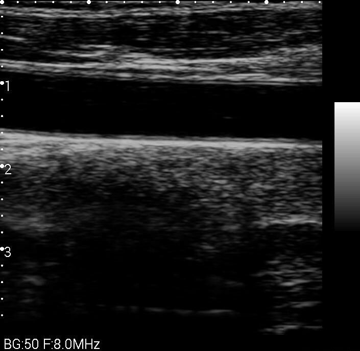 
                  
                    Veterinary Smart phones Ultrasound with  Convex probe 2.5-5MHz for Animals
                  
                