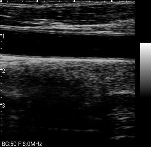 
                  
                    Veterinary Smart phones Ultrasound with  Convex probe 2.5-5MHz for Animals
                  
                