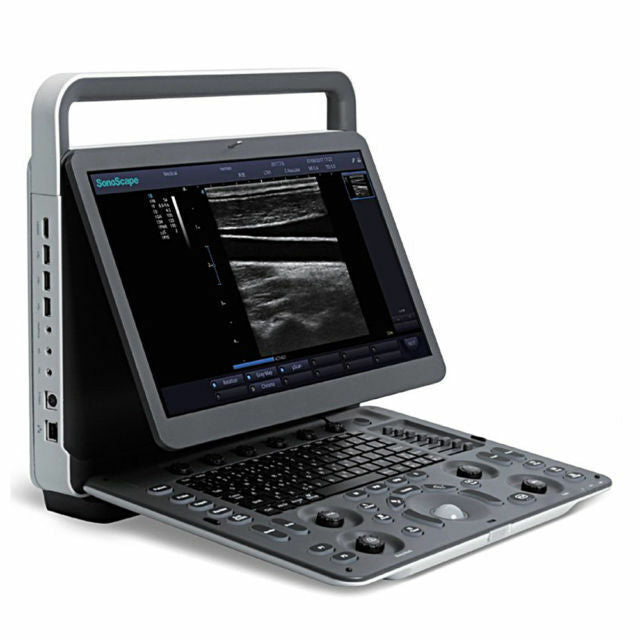 
                  
                    SonoScape E1 Portable Ultrasound Machine with Linear Array Probe L741
                  
                